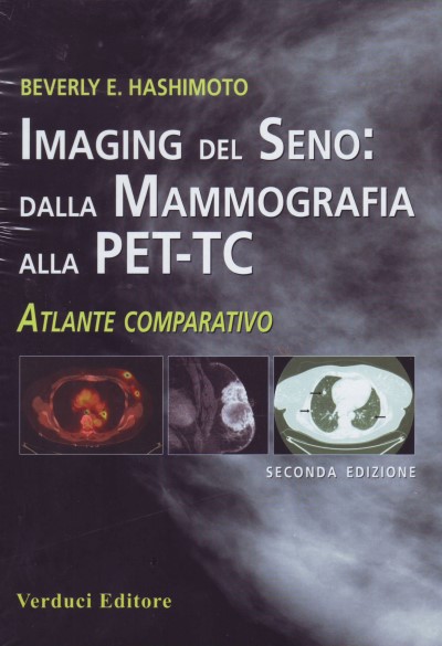 Imaging del Seno: dalla mammografia alla PET-TC